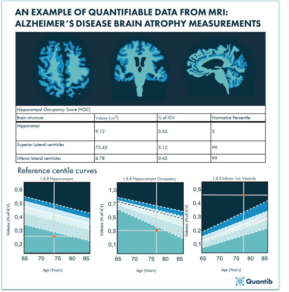 210716 - blog CT and MR for neuroimaging - f1