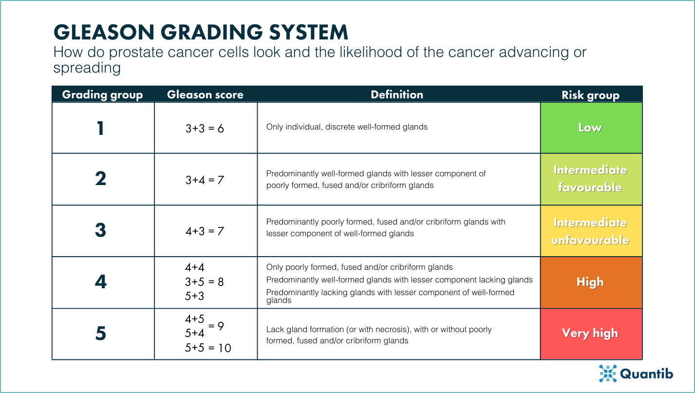 Gleason grading system cheat sheet