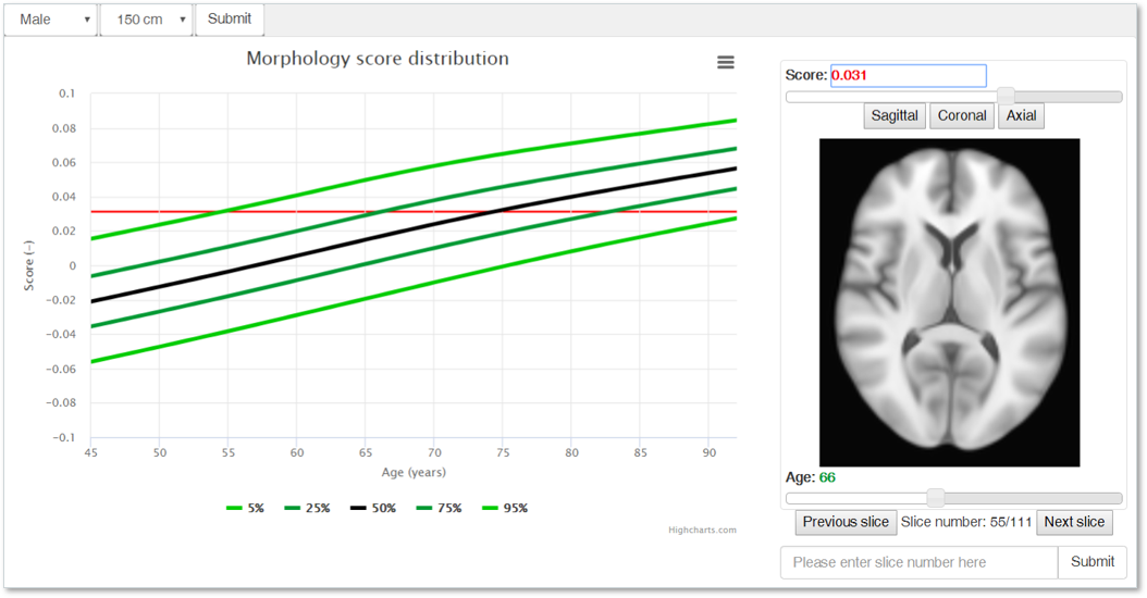 spatio-temporal reference model of the aging brain and morphology score distribution
