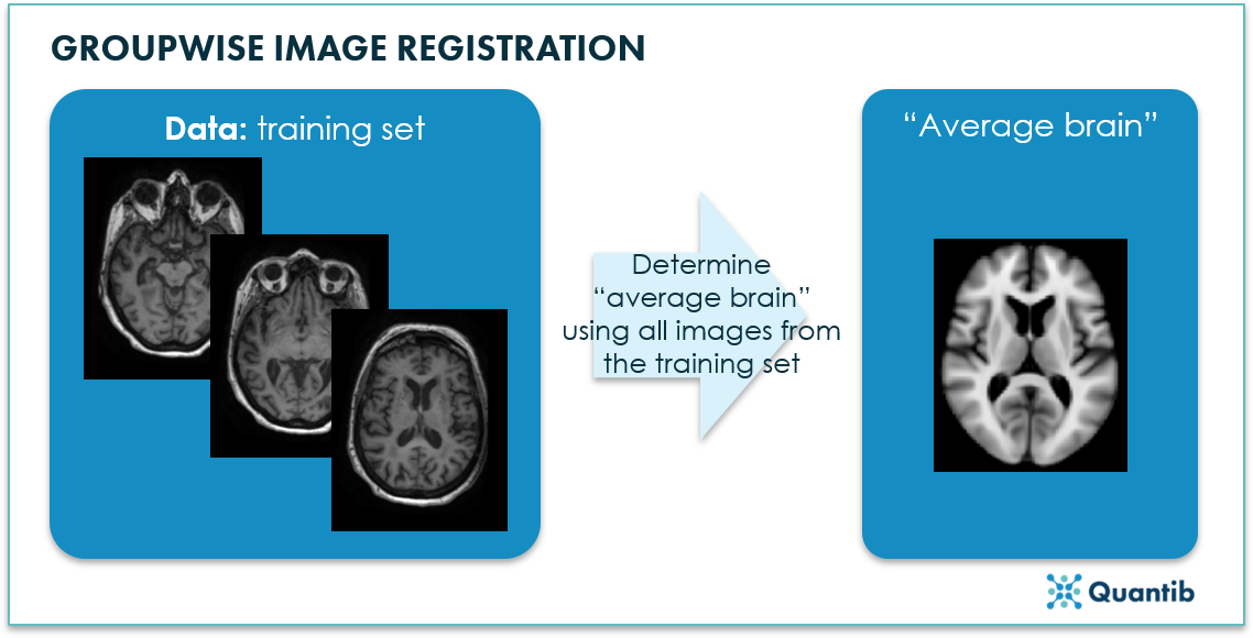 group-wise image registration MRI image of average brain determined from training set