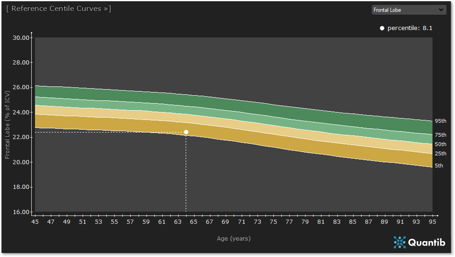 Quantib ND reference data for brain volumes, lobes, and hippocampus to quantify the aging brain