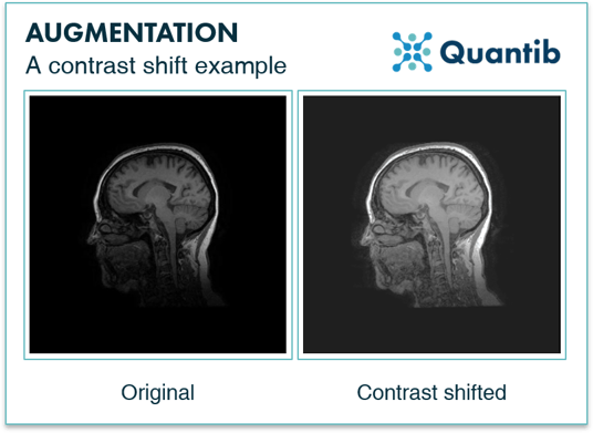 examples of contrast shift image augmentation illustrated with medical images