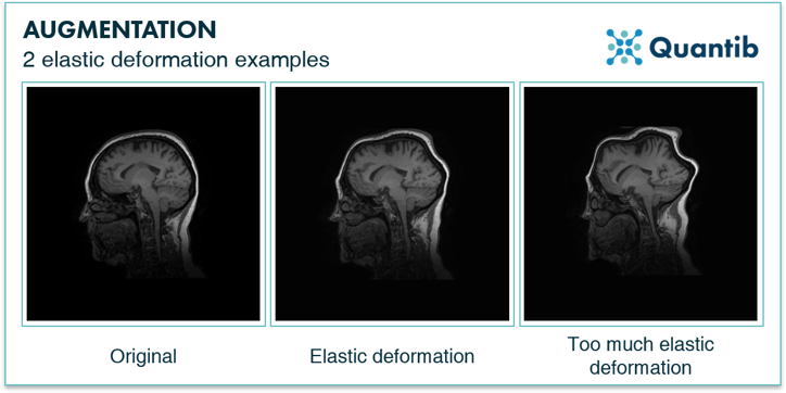 examples of elastic deformation image augmentation illustrated with medical images