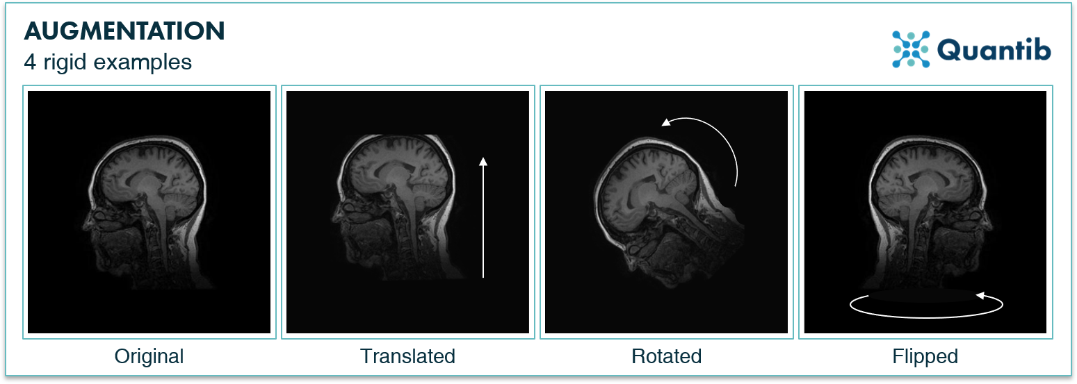 four examples of rigid image augmentation illustrated with medical images