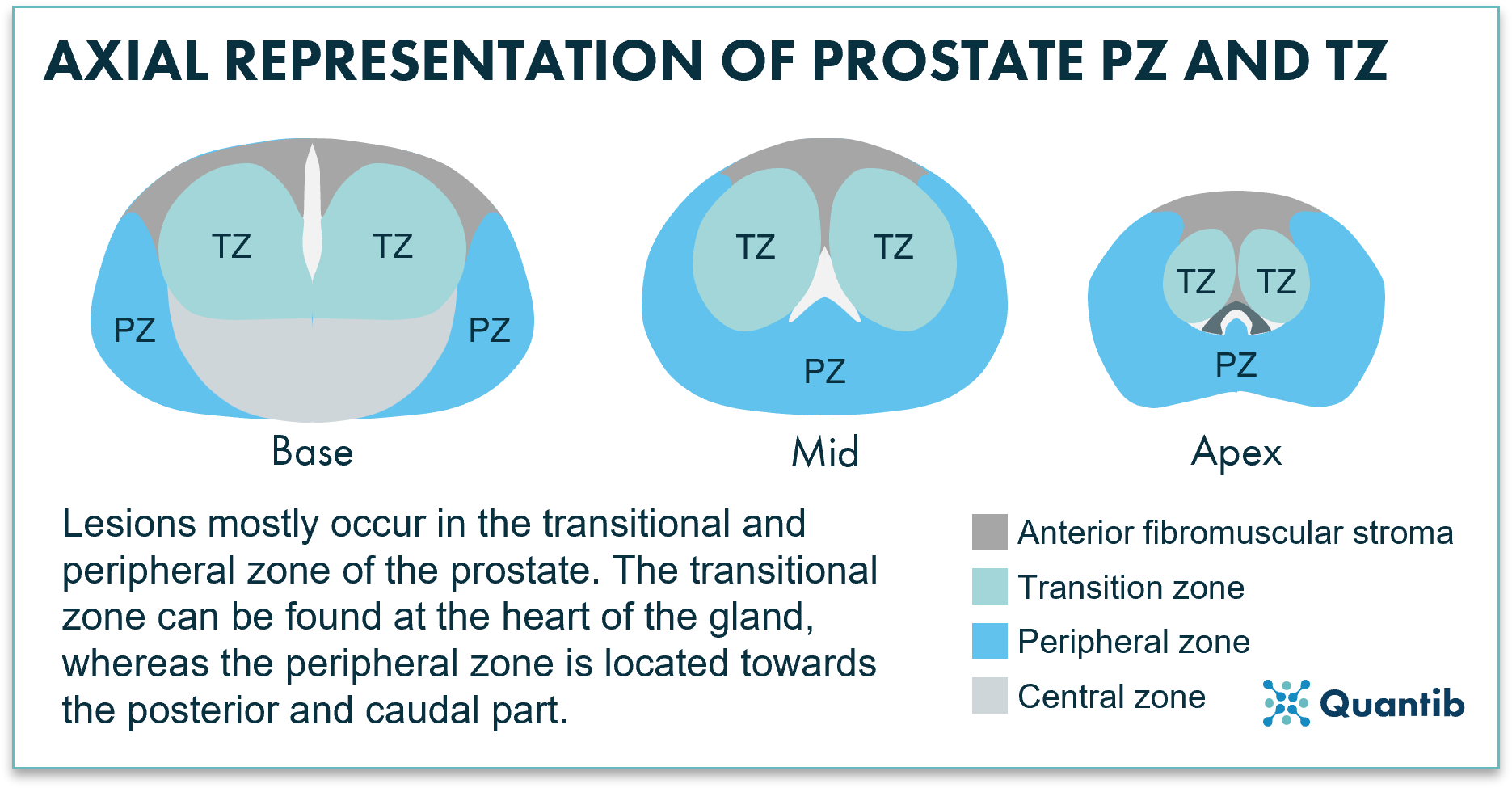 Axial representation of the prostate's peripheral and transition zones for PI-RADS scoring