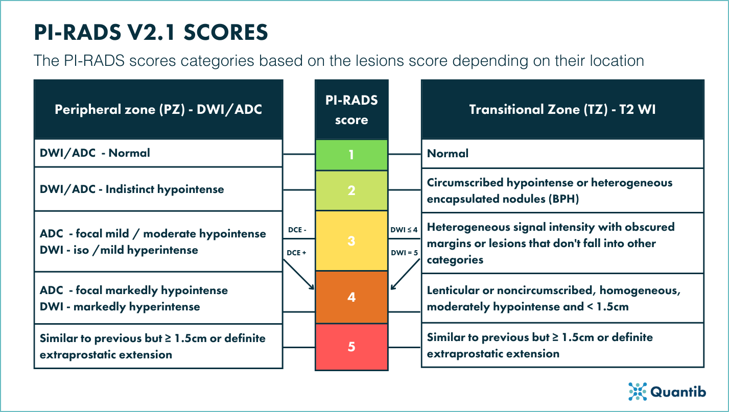 PI-RADS scoring v2.1 schematic overview