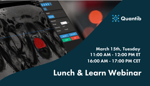 Thumbnail AI in Prostate MRI webinar with Edward Steiner