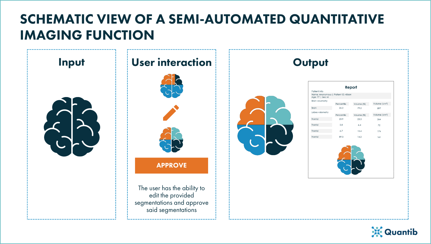 Schematic view of a semi-automated quantitative imaging funciton of a radiological device
