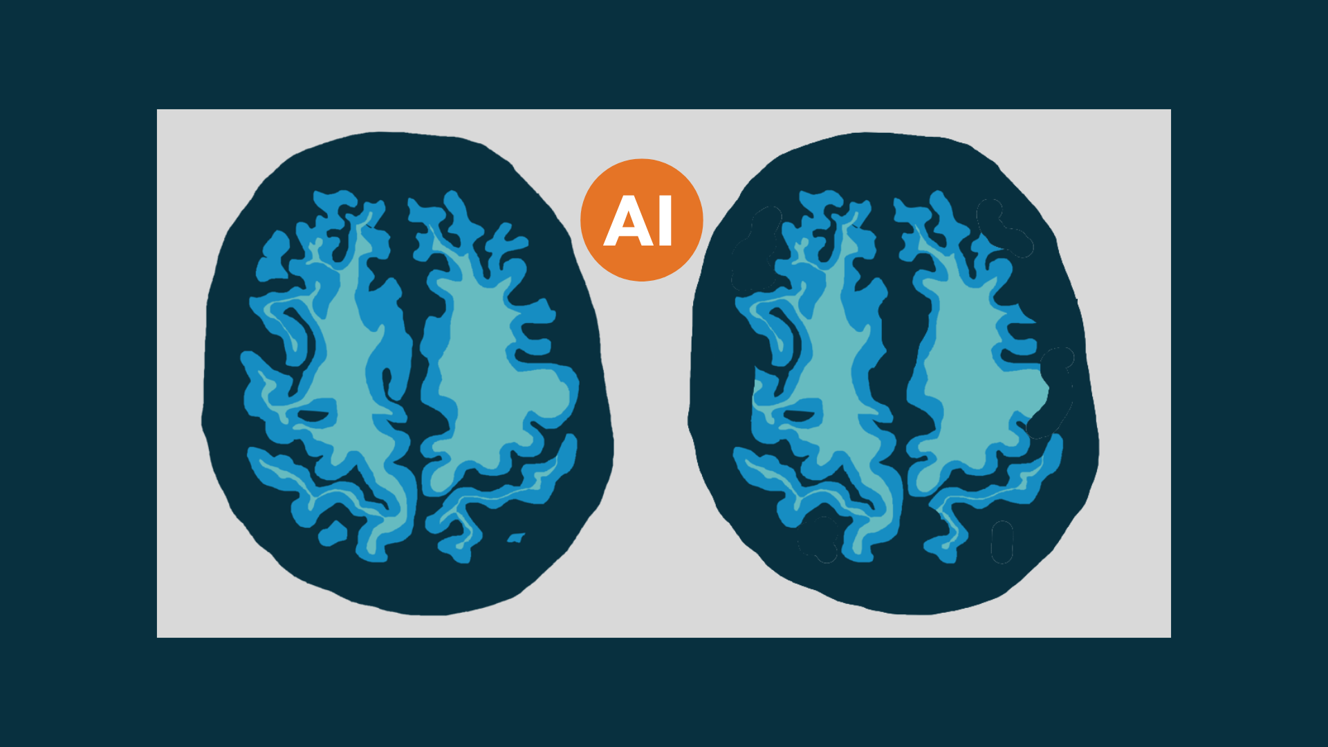 Homepage billboard - Dementia and AI