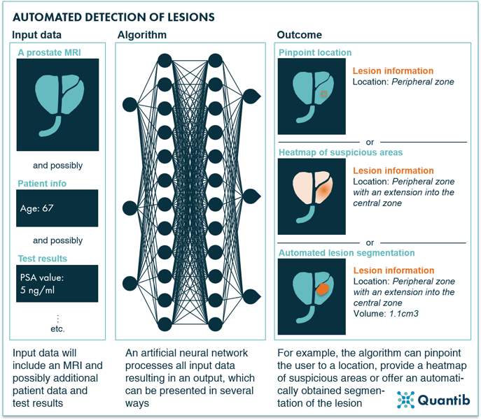 AI-driven automated detection of lesions based on prostate MRI