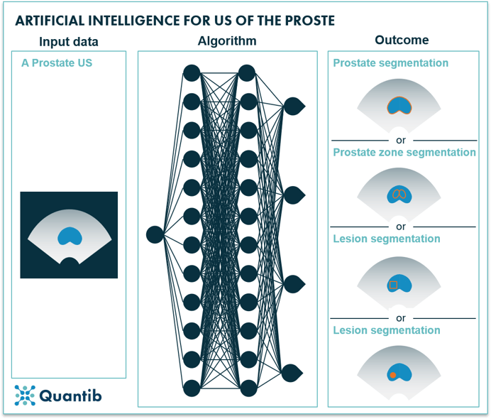 AI for prostate ultrasound