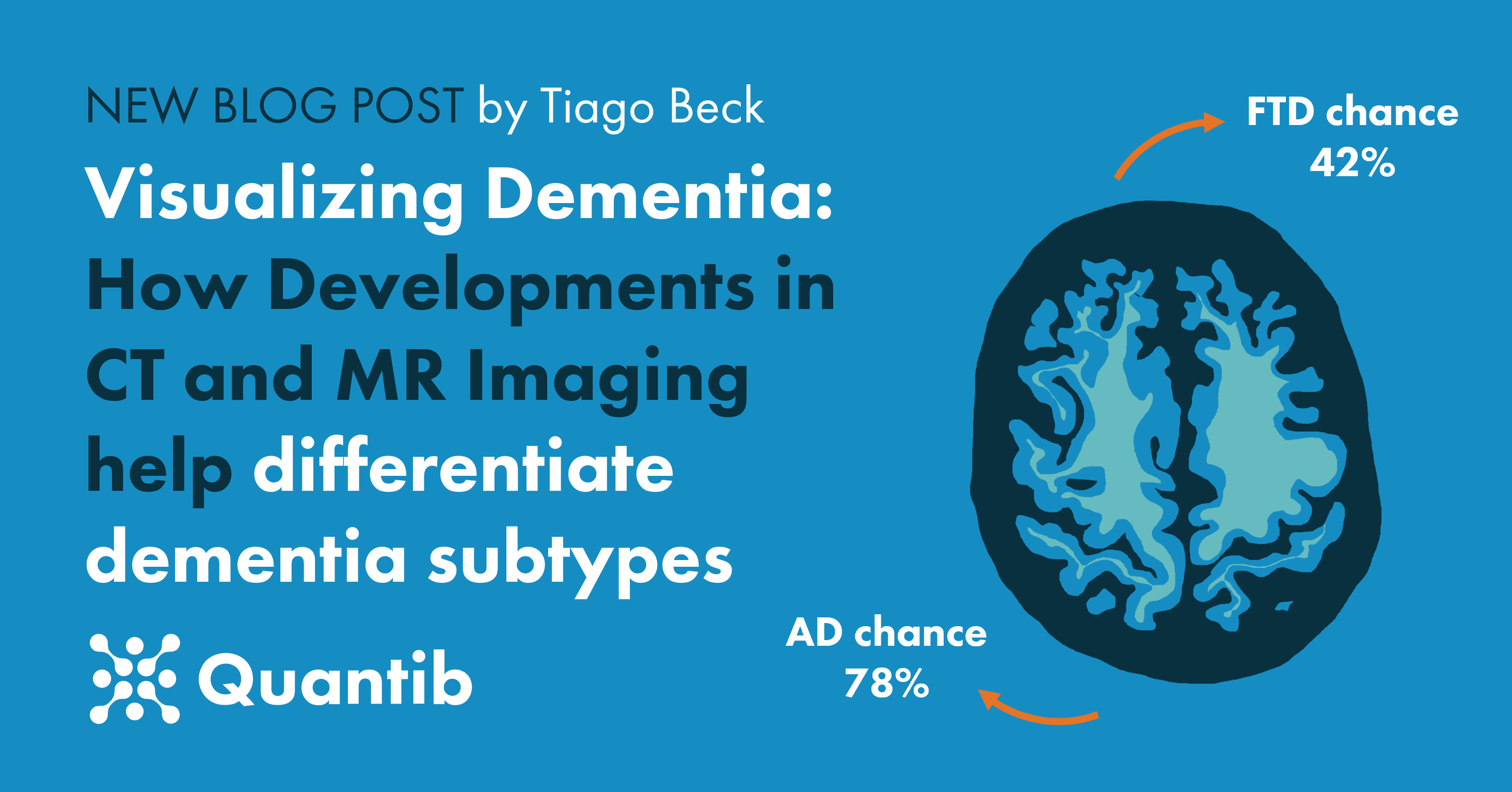 210716 - blog CT and MR for neuroimaging - social media post