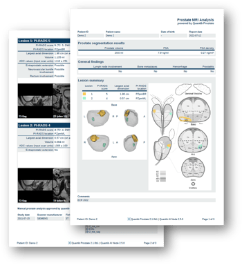 QP RSNA