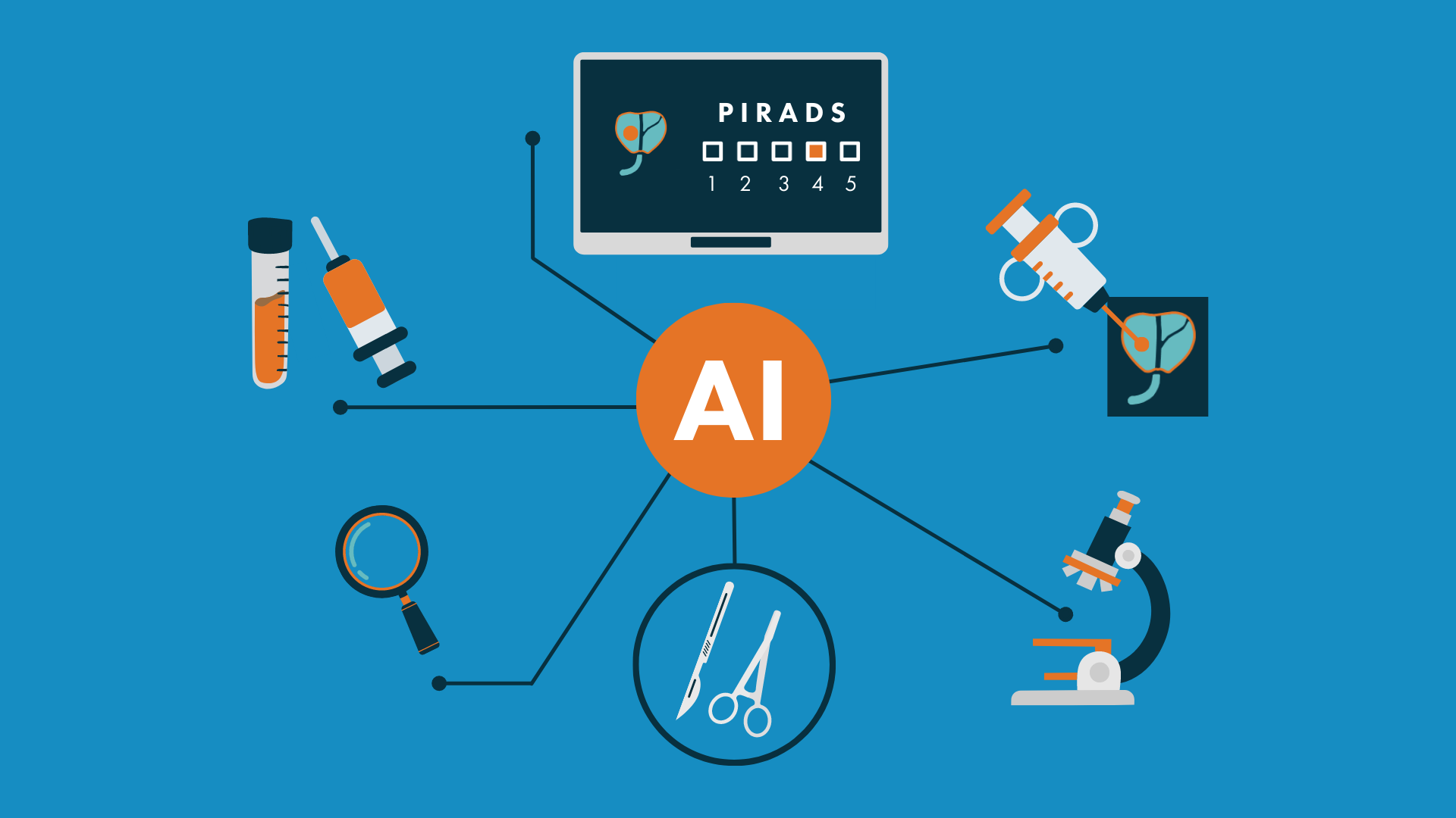 Homepage billboard - AI in the PCa pathway blog