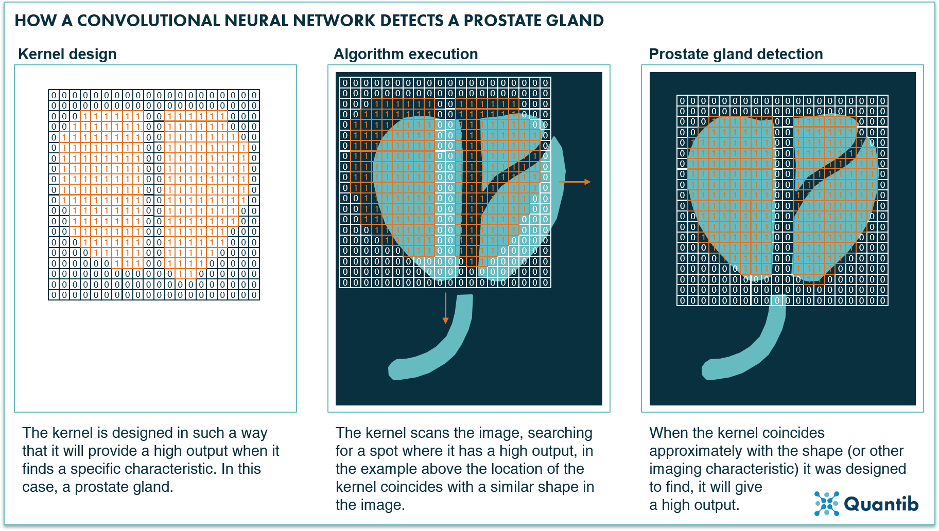 convolutional neural network prostate gland detection