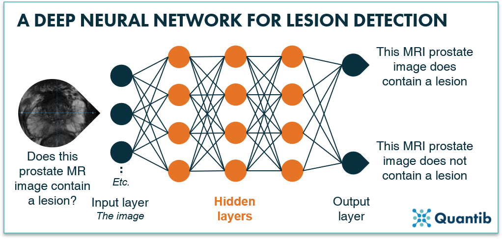 deep neural network lesion detection