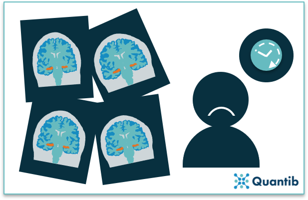 determining hippocampal volume manually is a time-consuming task