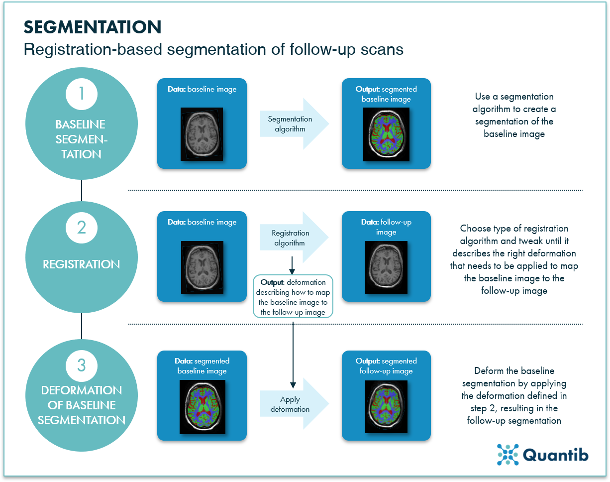 determining hippocampal volume using registration-based segmentation on brain MRI scans