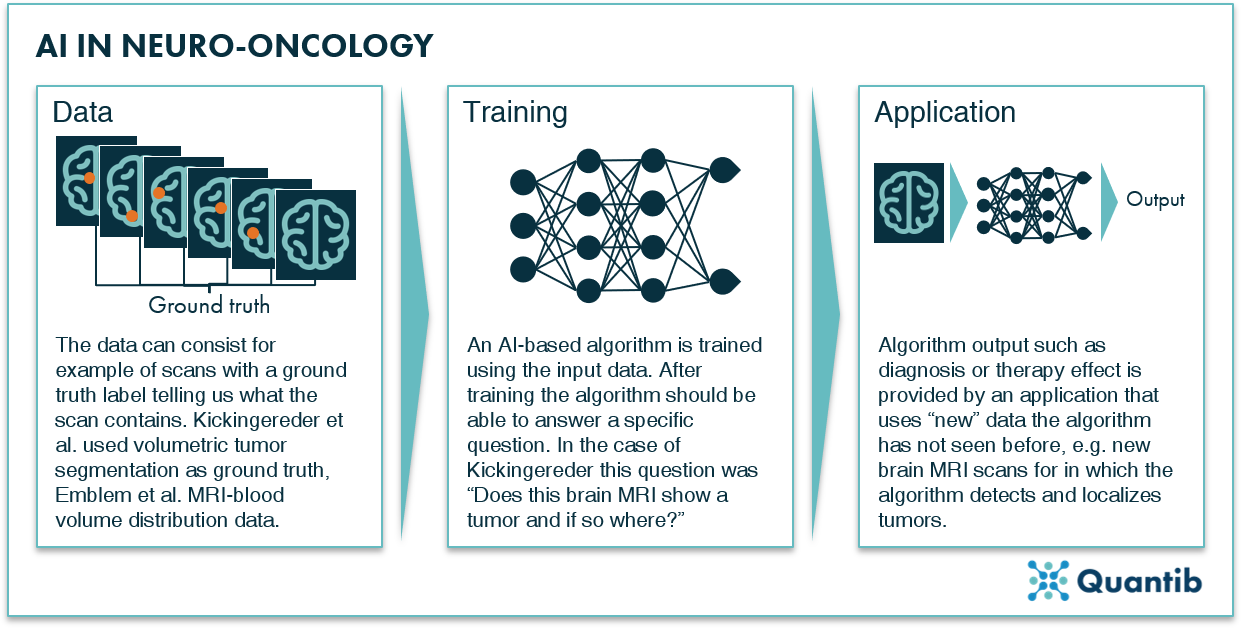 overview of how to train an algorithm for AI in neurology oncology problems