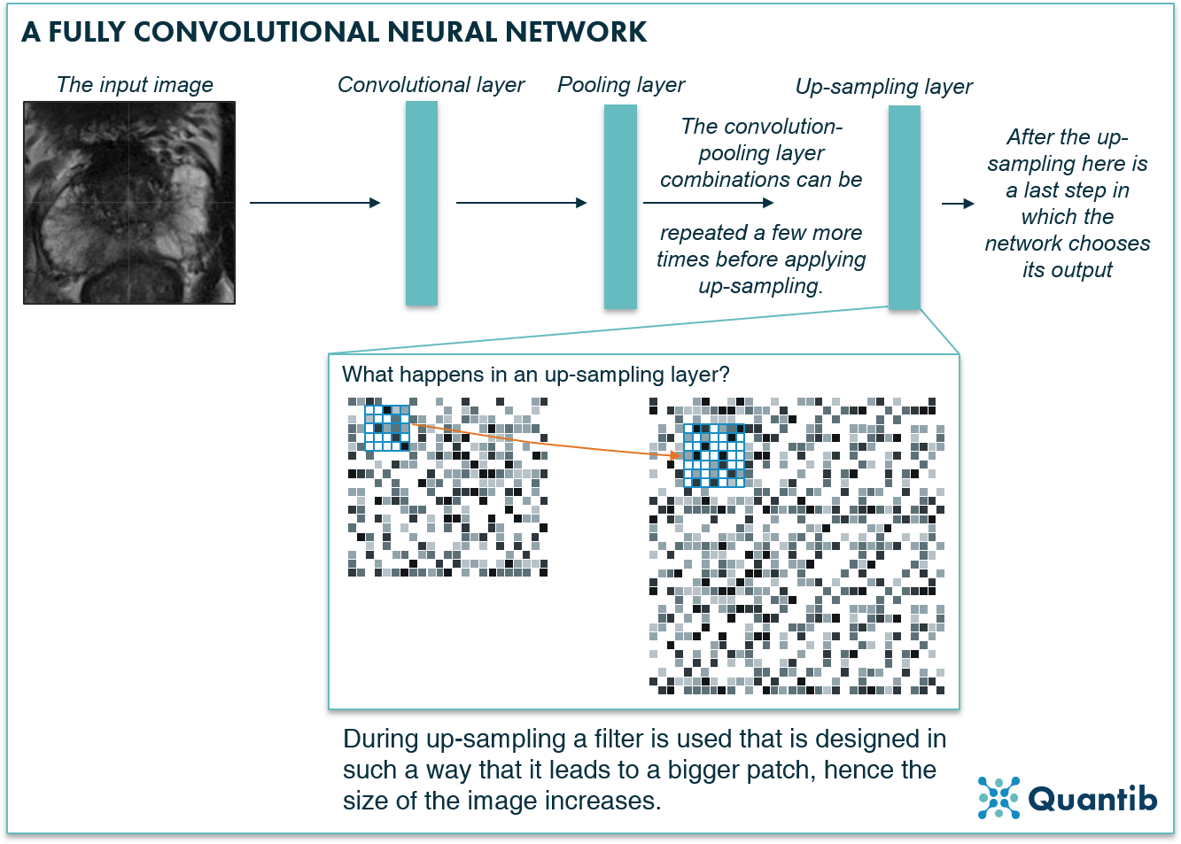 medical image segmentation for the prostate using a fully convolutional neural network explained in a schematic figure