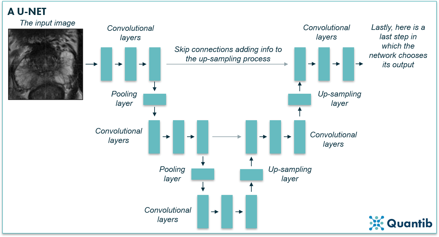 Deep learning applications in radiology: image segmentation