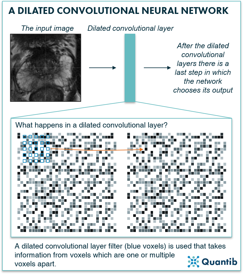 medical image segmentation for the prostate using a dilated convolutional neural network explained in a schematic figure