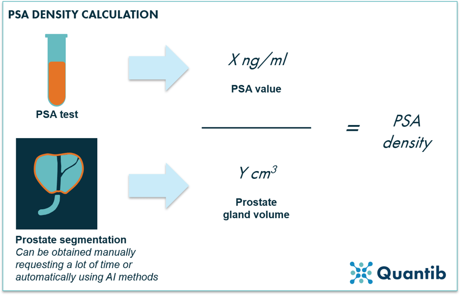 schematic figure showing calculation for PSA density using prostate MRI