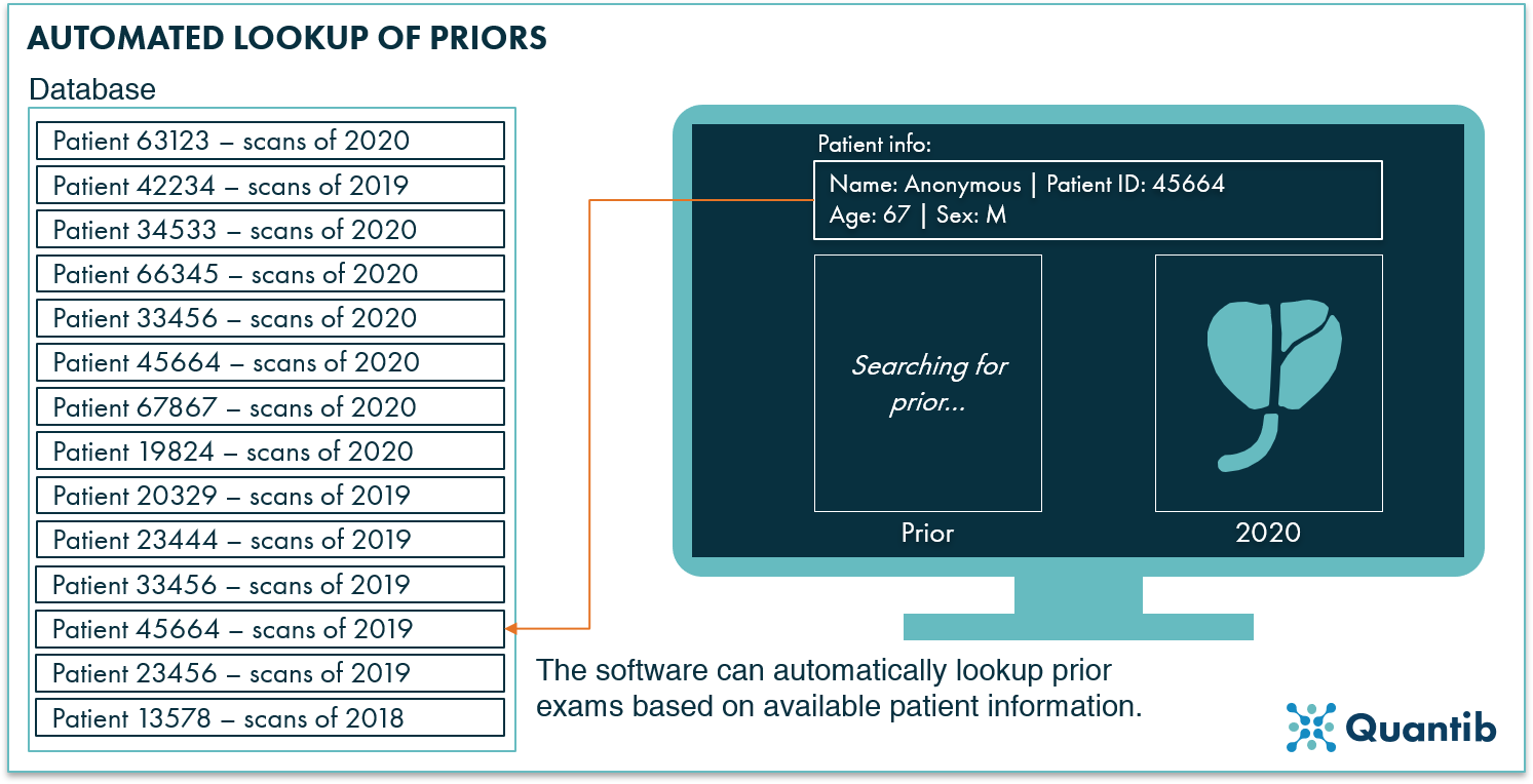 schematic figure showing how an AI algorithm can lookup prostate MRI priors