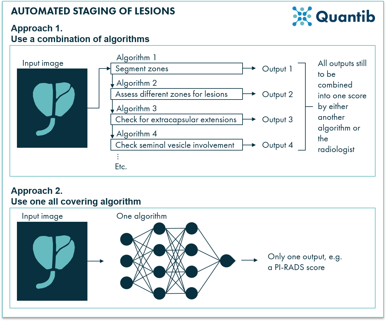 AI algorithms can support staging of lesions on prostate MRI in 2 ways