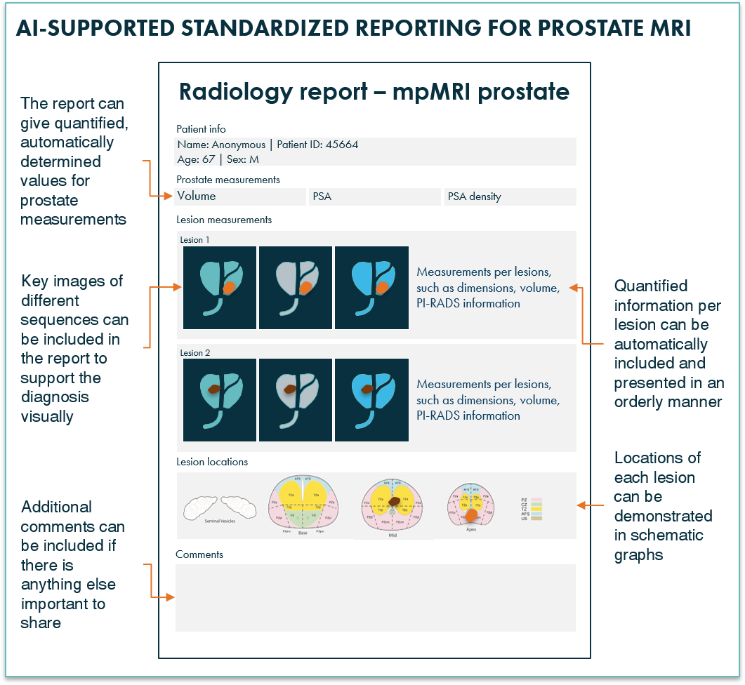 Prostate MRI report generated using AI prostate software