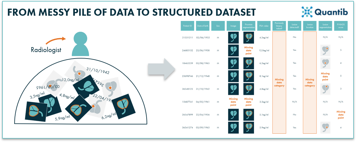 Infographic of a messy AI radiology data pile to a structured dataset