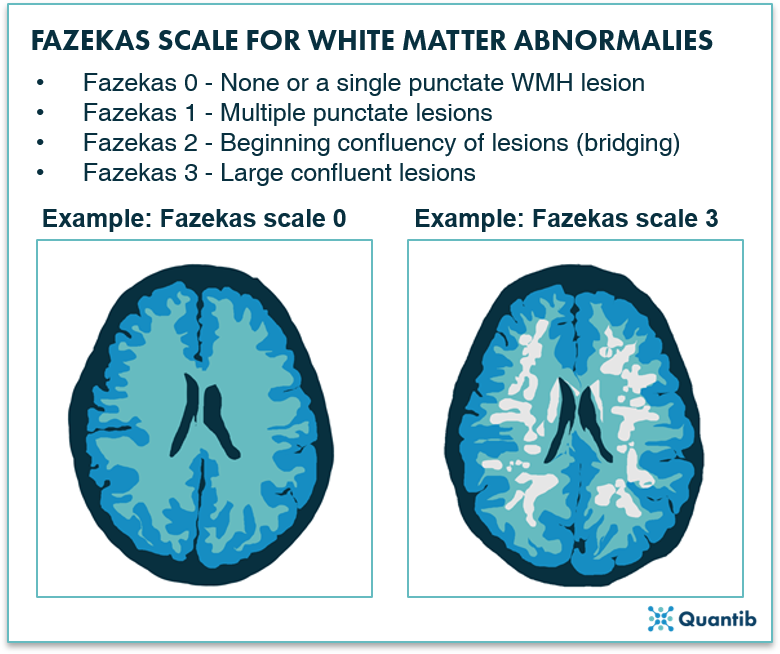 201104 - Qualitative radiology blog Tim - figure 1