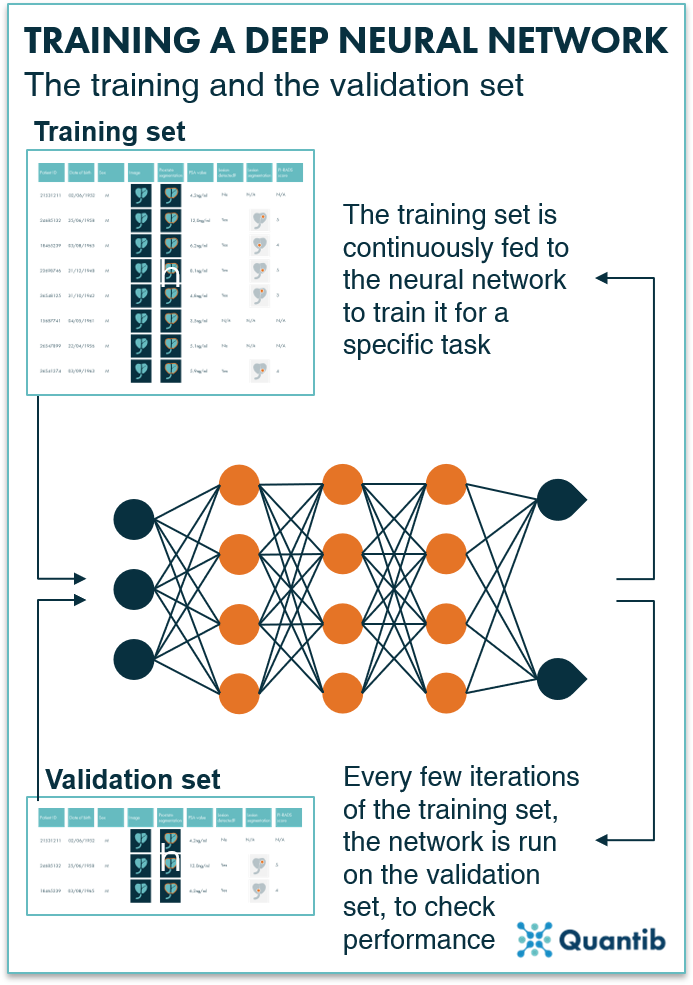 Schematic overview of how a training and validation set interact in training of a deep learning algorithm