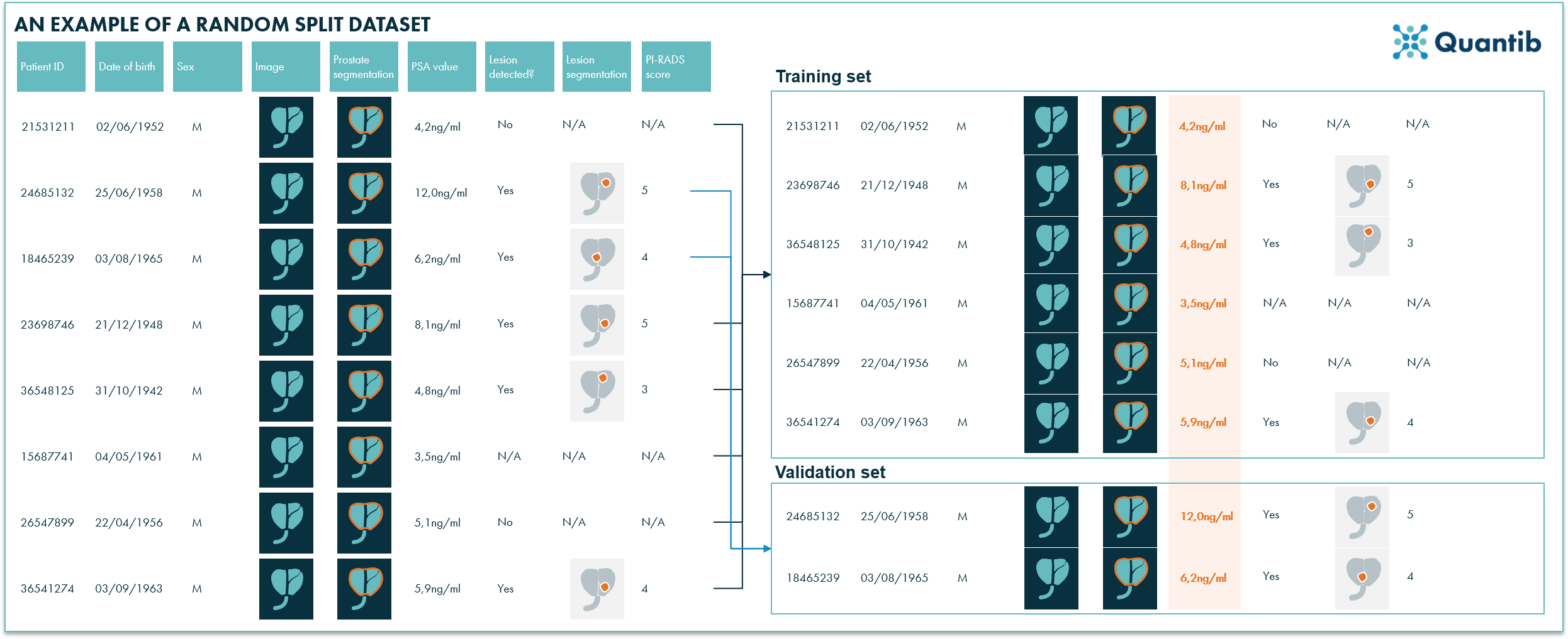 Schematic overview of how a medical imaging dataset is randomly split into a training and a validation set