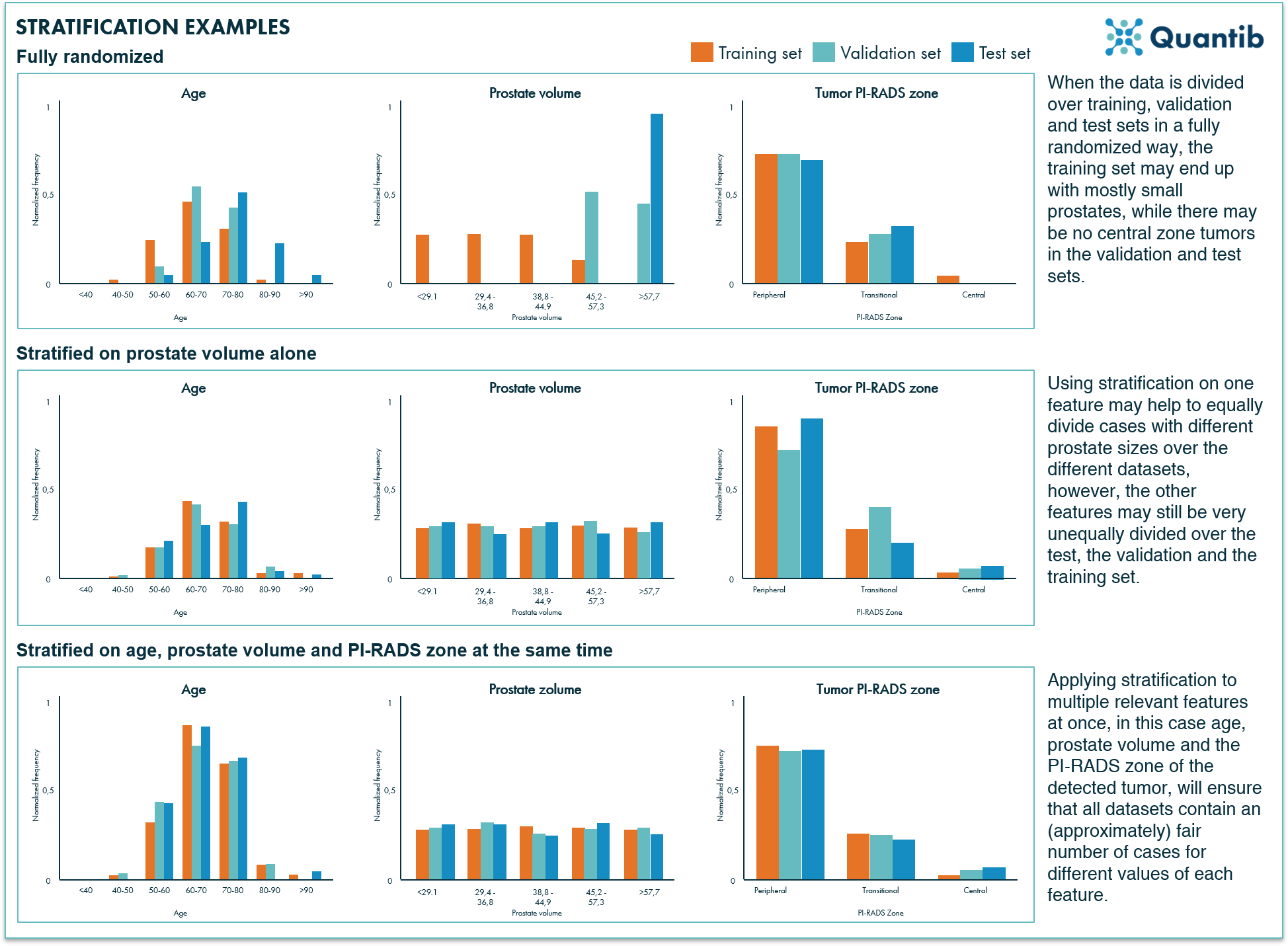 Prostate MRI based example graphs of stratification of imaging dataset