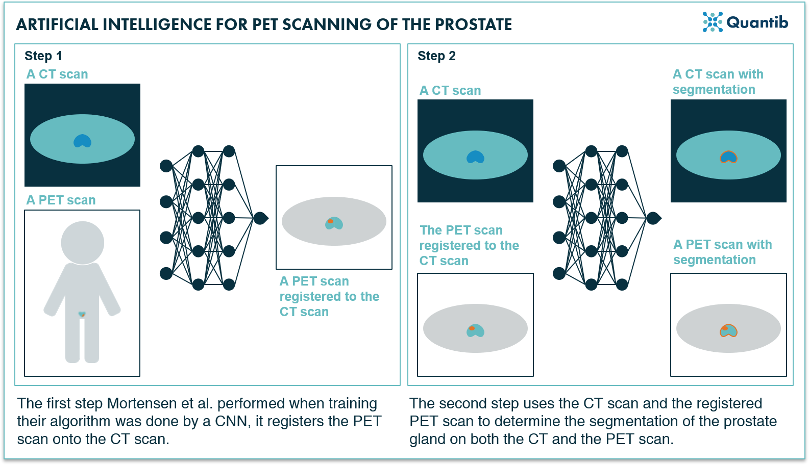 210428 - 5 papers on prostate AI - Image 2