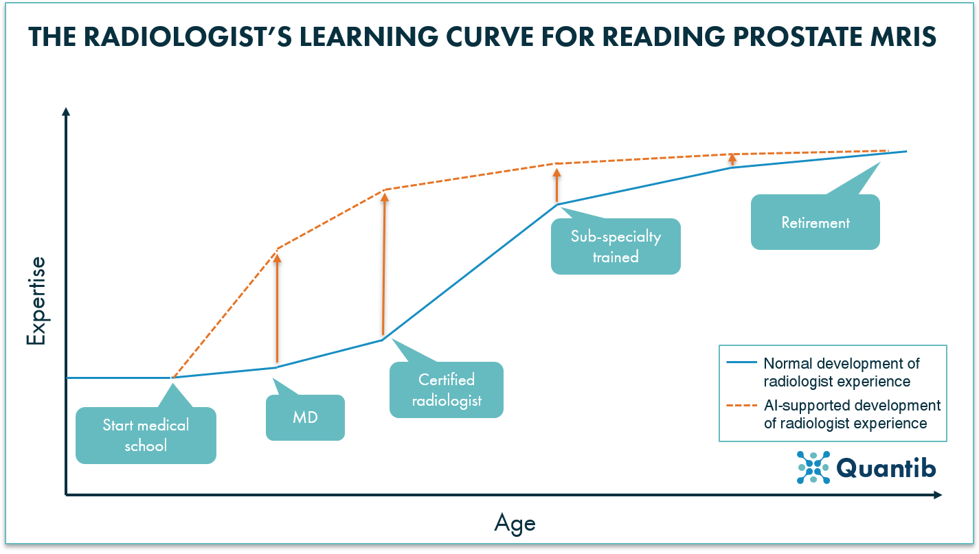 Radiologist's learning curve for reading prostate MRI