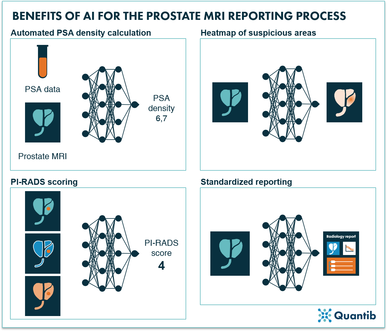 Benefits of AI for prostate MRI reporting