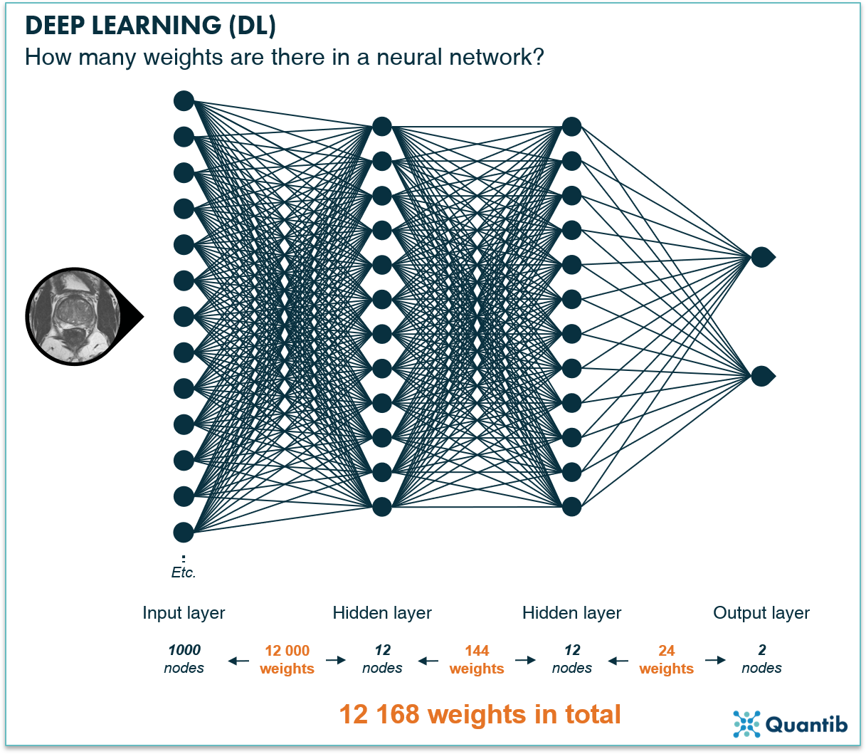 schematic figure illustrating deep learning in radiology explaining the amount of nodes in a deep neural network