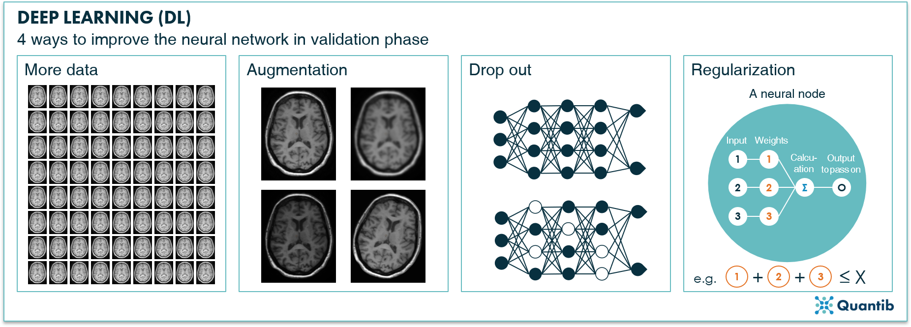 schematic figure illustrating deep learning in radiology explaining different techniques to improve a neural network in validation phase: adding data, augmentation, drop out, regularization
