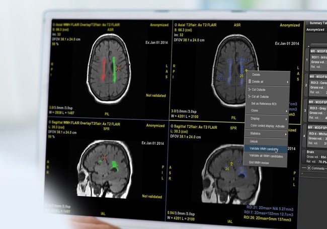 quantib-brain-feature