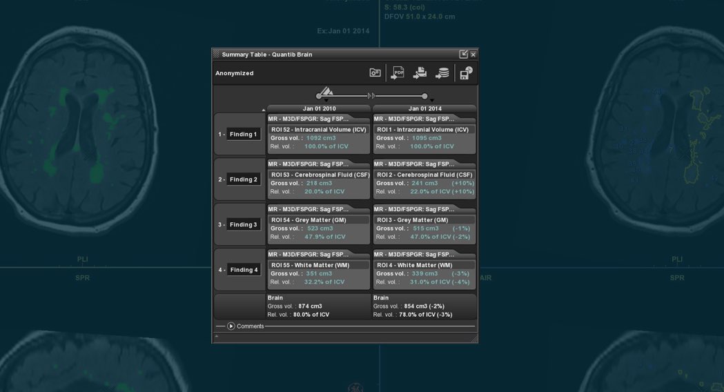 quantib-brain-summary-table