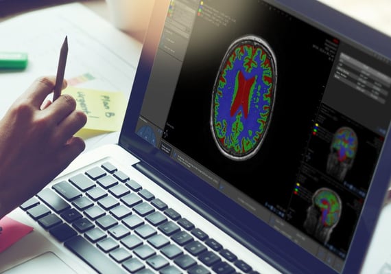 brain segmentation software