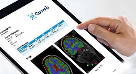 Quantib Brain Radiology Software | Quantib BV