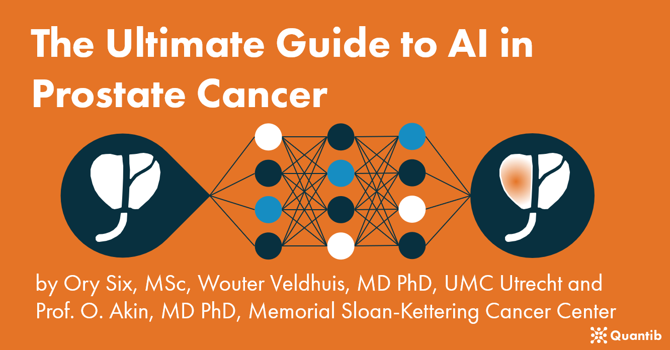 AI in prostate cancer - homepage image-1