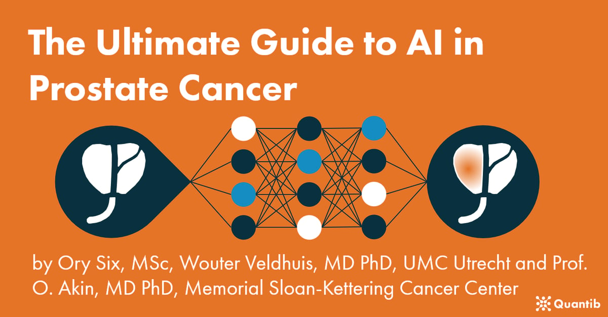 AI in prostate cancer - homepage image
