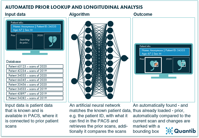 AI in prostate oncology - figure 11