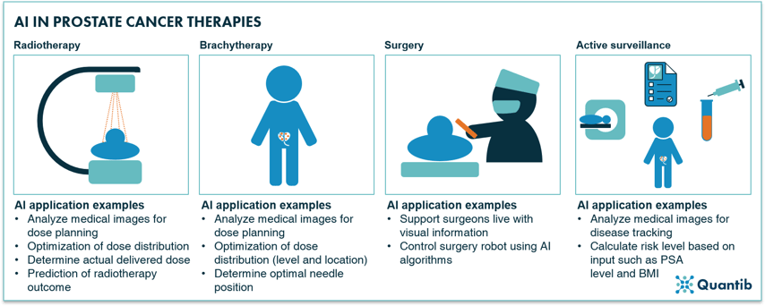 AI applied to prostate cancer therapies