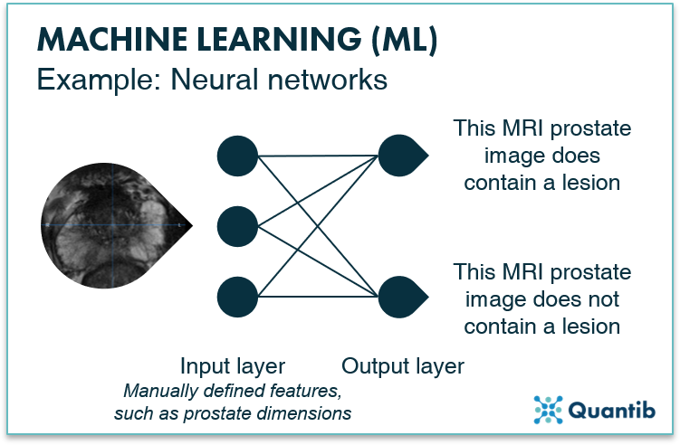 AI in prostate oncology - figure 5