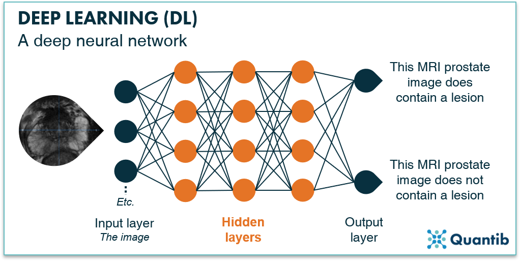 AI in prostate oncology - figure 6